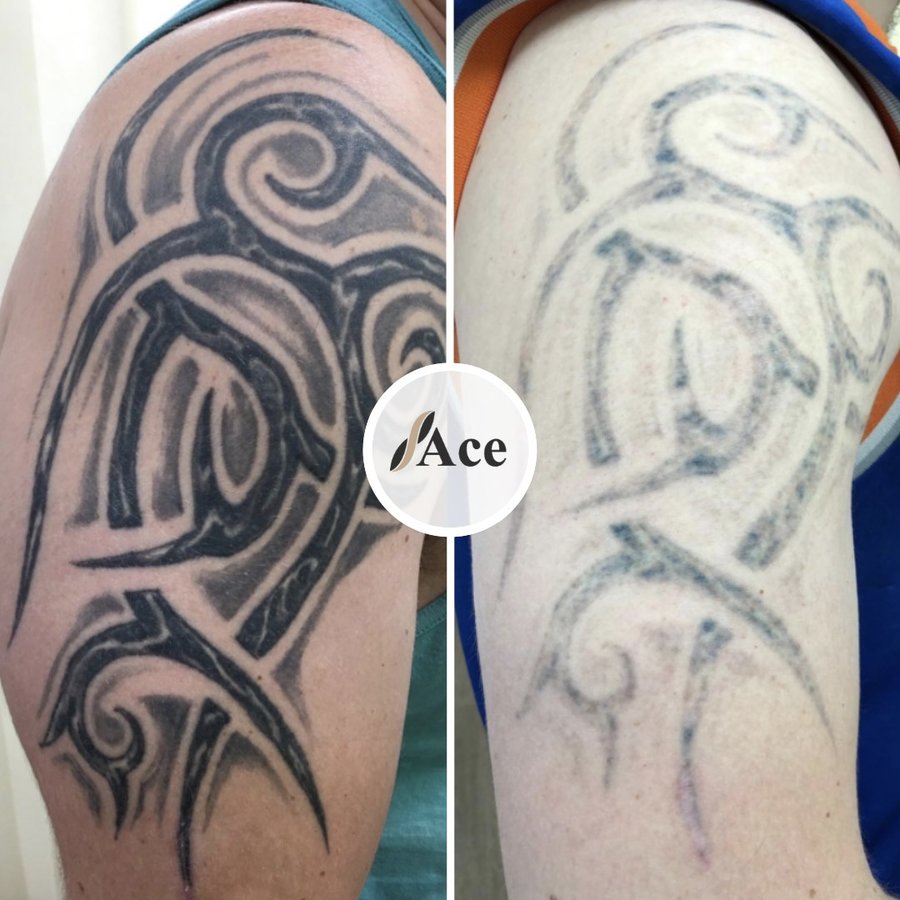 Ace Aesthetics - Ace Aesthetics